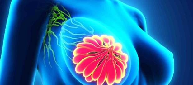 Dolore al seno: valutarne le cause per prevenire il tumore Dolore al seno: valutarne le cause per prevenire il tumore