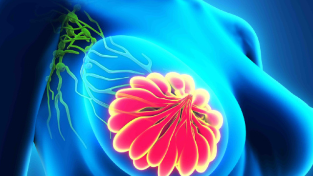 Dolore al seno: valutarne le cause per prevenire il tumore