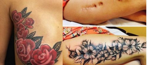Belas tatuagens para esconder marcas no corpo.(Foto/Reprodução via Incrível Club).