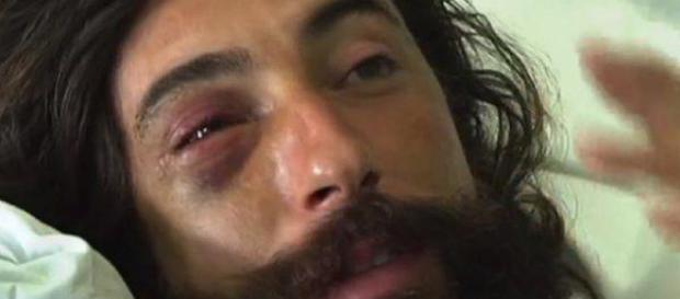 Trani, Brumotti aggredito durante un servizio sullo spaccio Trani, Brumotti aggredito durante un servizio sullo spaccio