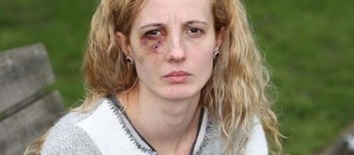 Anca Si Piticii, la giovane mamma di origine polacca, picchiata selvaggiamente dalla baby gang