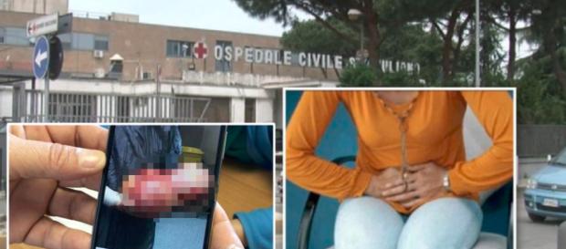 Sembrava incinta, napoletana salvata a 17 anni da tumore gigante Sembrava incinta, napoletana salvata a 17 anni da tumore gigante