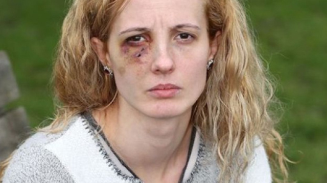 Anca Si Piticii, la giovane mamma di origine polacca, picchiata selvaggiamente dalla baby gang