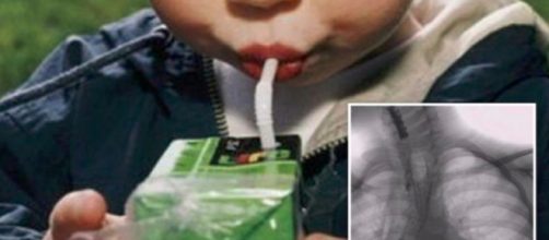 Bari. Acido nel succo di frutta, bimbo di 5 anni con stomaco e esofago bruciati - Teleclubitalia