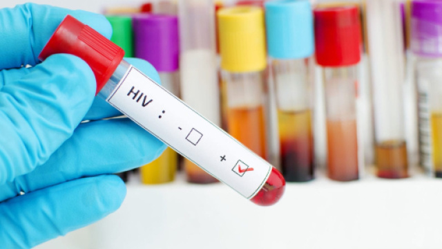 Bari, rapporto intimo non protetto con una donna: arrestato uomo sieropositivo