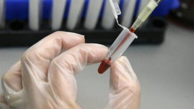 Con le cellule staminali si può sconfiggere l'AIDS (fonte viverepiusani.it)