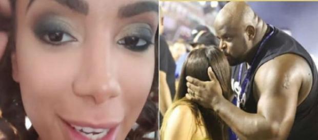 Anitta exibe machucado na cabeça (Foto: Reprodução/ Instagram) Anitta exibe machucado na cabeça (Foto: Reprodução/ Instagram)