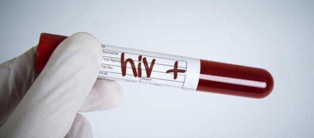 Fotografía de archivo del virus VIH Fotografía de archivo del virus VIH