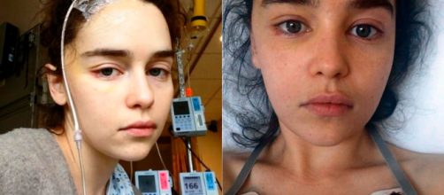 Emilia Clarke de "Game of Thrones" mostró imágenes íntimas de su estancia en un hospital