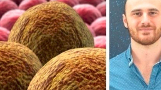 Tumori bruciati in un secondo con fasci di elettroni: la scoperta di un fisico pugliese