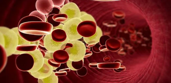 Nelle donne il colesterolo Ldl è molto pericoloso anche a bassi livelli. Nelle donne il colesterolo Ldl è molto pericoloso anche a bassi livelli.