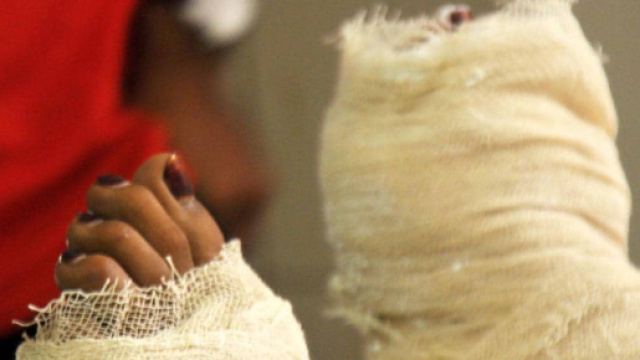 Dacca, ragazza bruciata viva sul tetto della scuola