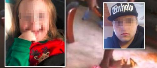 Patrigno picchia a morte bimba down di 4 anni: 'Mi interrompeva mentre parlavo' - Teleclubitalia