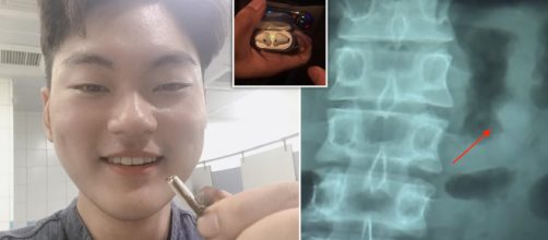 Apple's AirPods Still Functional In Man's Stomach After Being ... - joy105.com