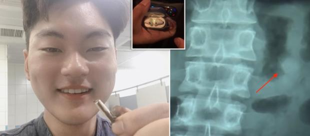 Apple's AirPods Still Functional In Man's Stomach After Being ... - joy105.com Apple's AirPods Still Functional In Man's Stomach After Being ... - joy105.com