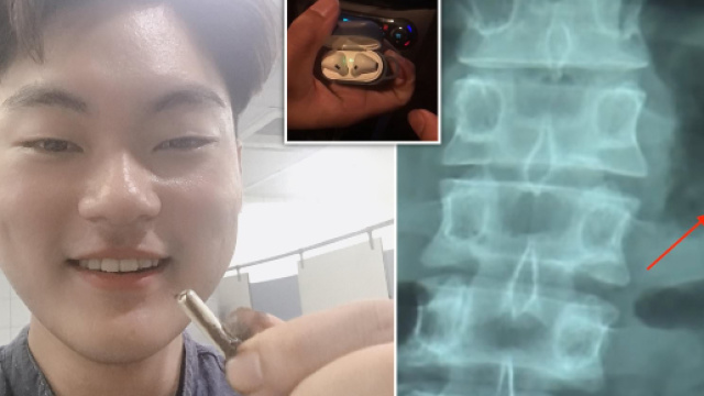 Apple's AirPods Still Functional In Man's Stomach After Being ... - joy105.com