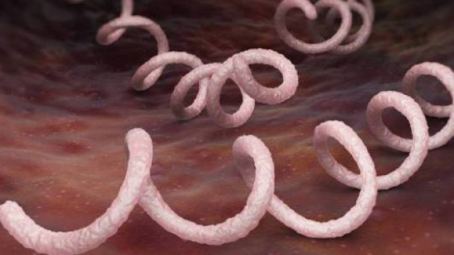 Sifilide, la malattia arriv&ograve; in Europa dopo la scoperta dell'America