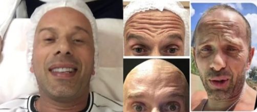 Rafael Ilha realizou procedimento de harmonização facial e botox. (Reprodução/Instagram/@rafael_ilha_oficial)