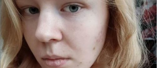 Noa Pothoven, solicitó la eutanasia al no poder aguantar los traumas por haber sido violada