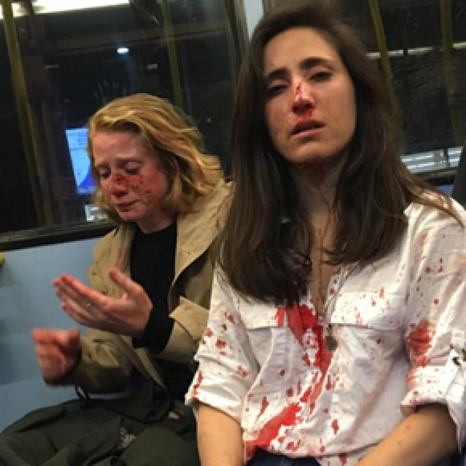 Una pareja de lesbianas sufre una agresión homófoba en un autobús