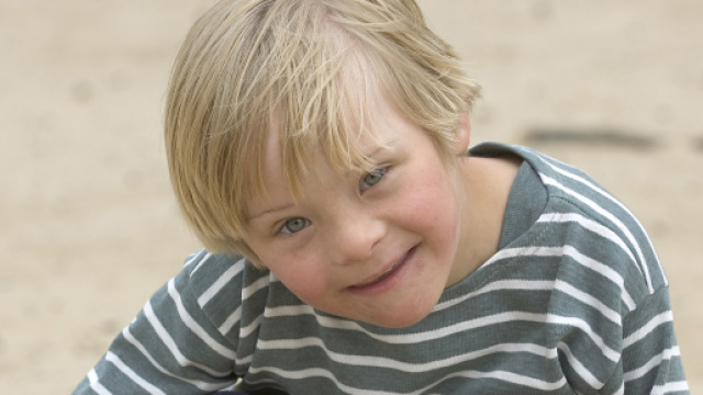 Existe t-il différentes formes de trisomie 21 ? - hizy.org