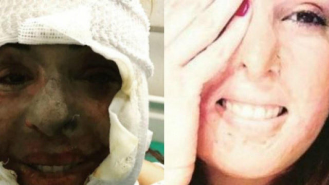 Gessica Notaro posta la foto scattata subito dopo l'aggressione ... - 105.net