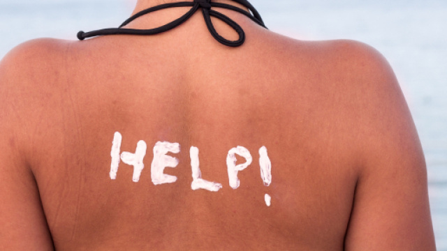 Soulager un coup de soleil : 5 remèdes naturels facile à faire ... - topsante.com