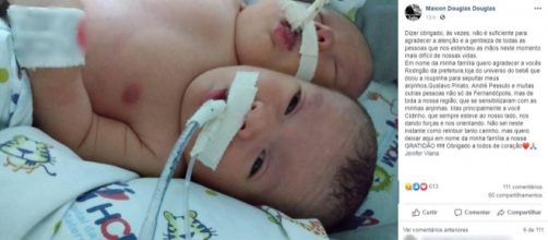 Gêmeas siamesas faleceram após uma semana de vida. (Reprodução/ Facebook)