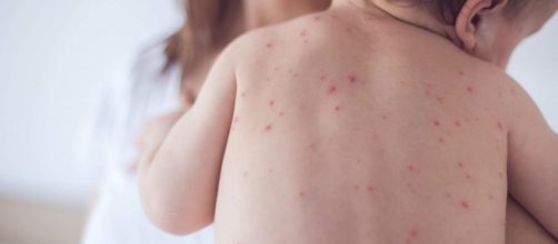 Crianças e adultos devem procurar o posto para imunizar contra o sarampo. (Arquivo Blasting News)