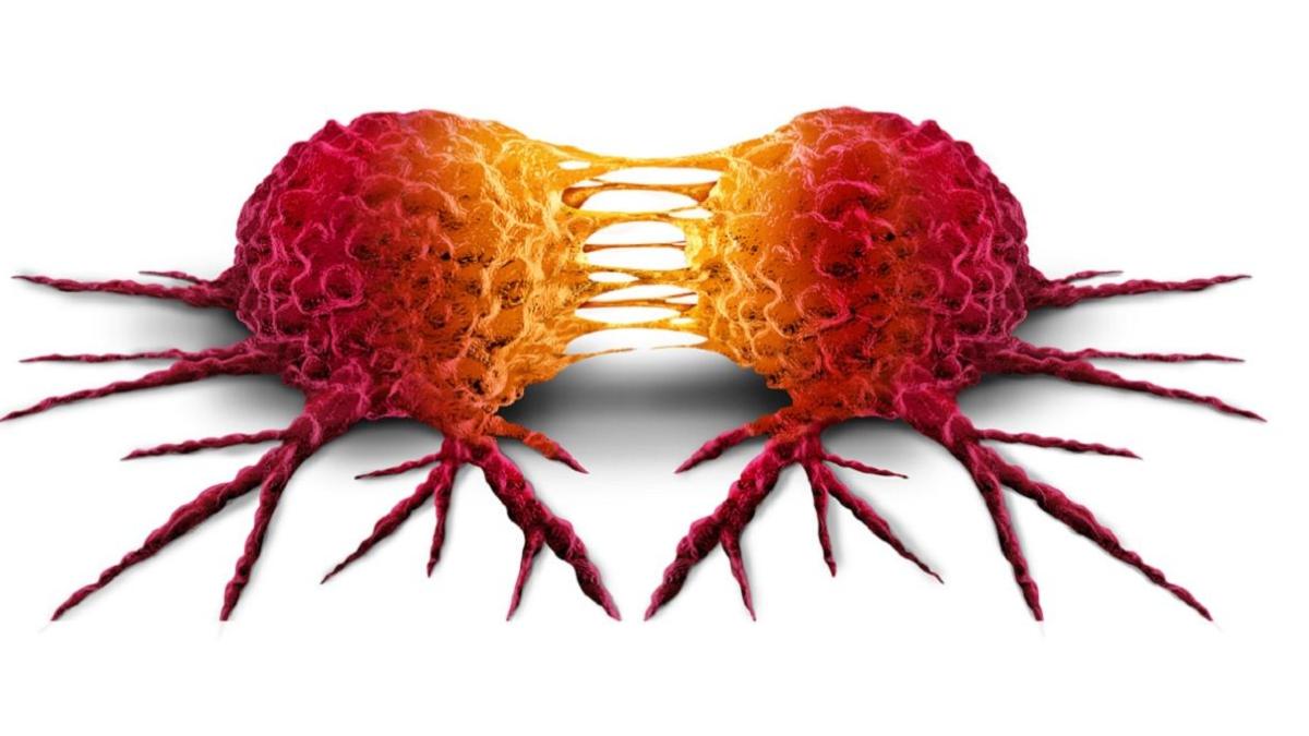 Metastasi Tumorali Lespressione Della Proteina L1cam