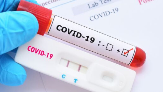 Coronavirus, caos all'ospedale Cotugno di Napoli dove scarseggiano i posti letto.