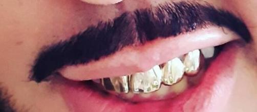 Dentes de ouro são símbolos de luxo e poder. (Arquivo Blasting News)