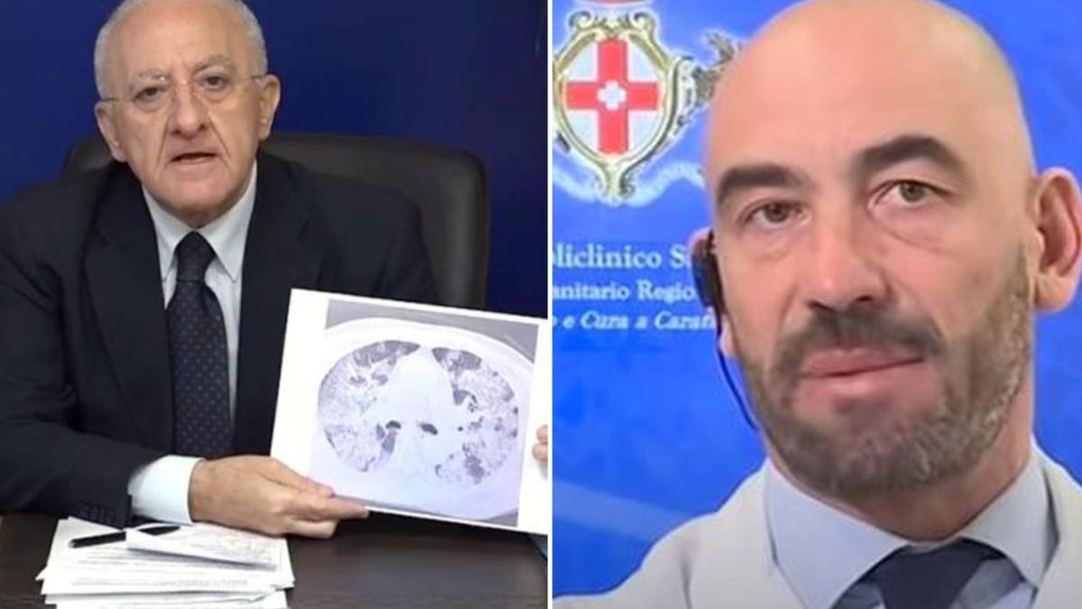 Coronavirus Bassetti Vs De Luca Ci Ho Messo 30 Anni Di Studio Per Spiegare Una Tac