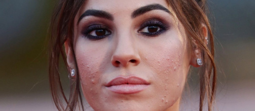 Giulia De Lellis, sfogo per l'acne: 'Ogni cura sembra fallire, fatico a guardarmi così'.