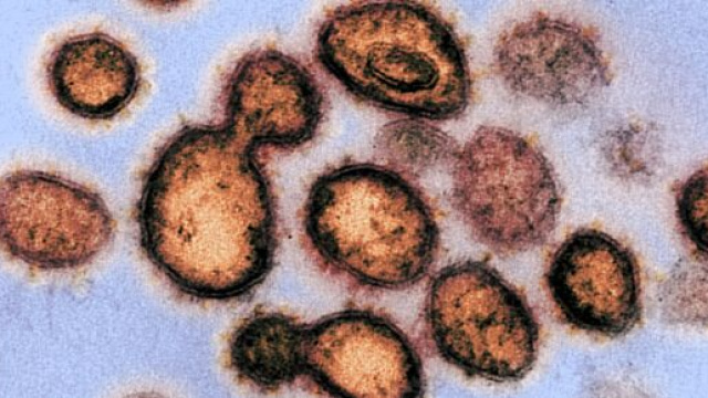 Coronavirus previste nuove misure restrittive.
