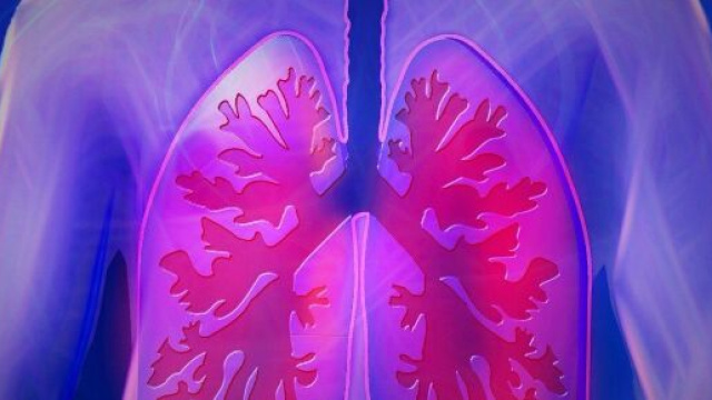 Un'ecografia ai polmoni potrebbe diagnosticare rapidamente il coronavirus.