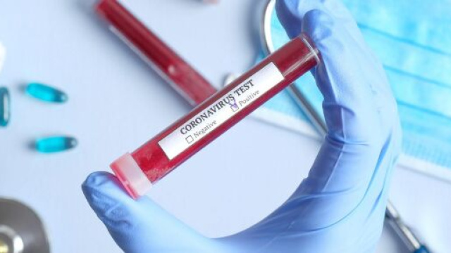 Il bilancio dei casi di contagio da coronavirus continua ad aumentare.