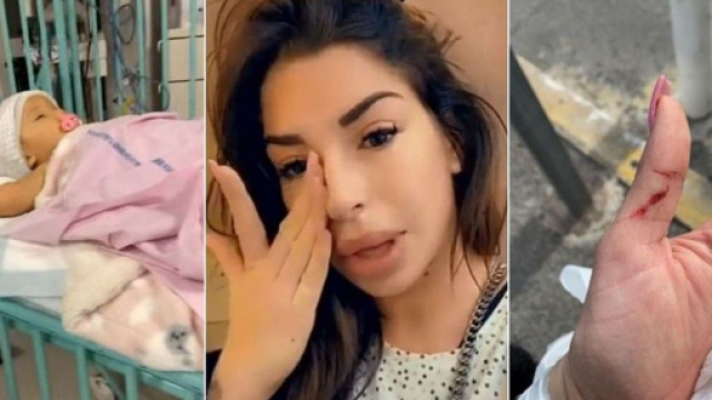 Liam Di Benedetto avoue avoir subi une chirurgie des fesses pendant que Joy était à l'hôpital et raconte sa bagarre avec le père de sa fille.