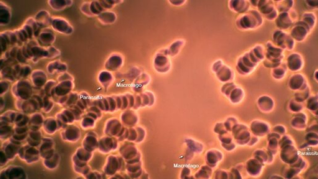 Un'immagine di vista dal microscopio