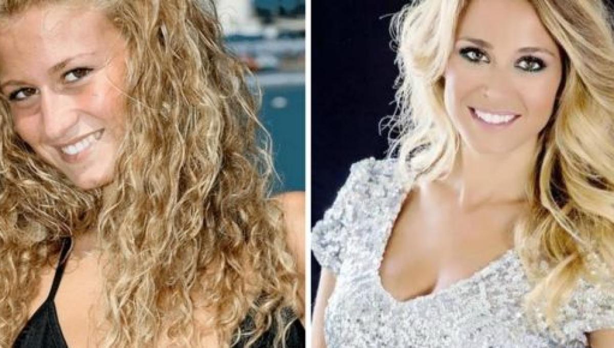 Diletta Leotta Prima : Diletta Leotta Prima E Dopo La Chirurgia