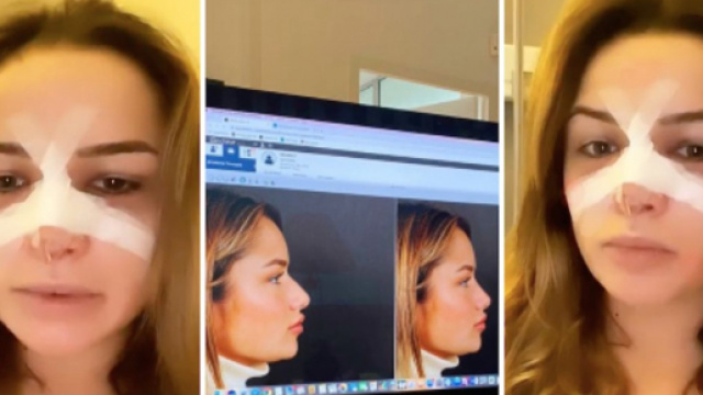 LMAC : Victoria Méhault s'est faite refaire le nez. Credit : Instagram/ victoia_méhault