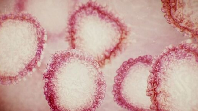 Coronavirus, in provincia di Pavia un paesino senza infetti: &egrave; Ferrera Erbognone, si studia sangue degli abitanti.