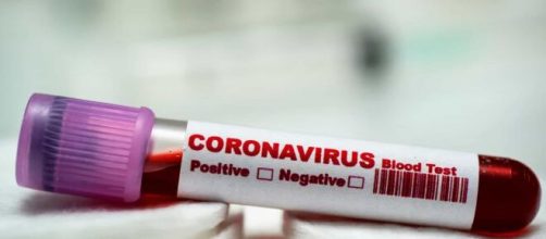 Sobe para 114 o número de mortes por coronavírus no Brasil. (Arquivo Blasting News)