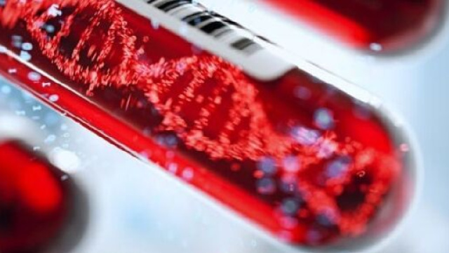 Su un campione di sangue, grazie ad un software che sfrutta l’intelligenza artificiale, si identificano 50 tumori ancora precoci, asintomatici.