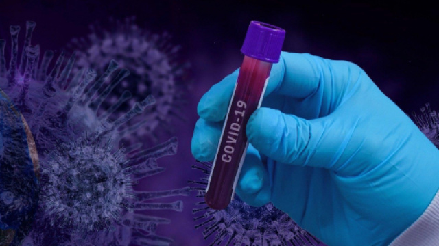 Test del sangue per il Coronavirus, la raccolta firme rivolta al Presidente Conte punta a raccogliere 25 mila firme.