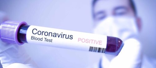 En julio se comenzará a aplicar inmunoglobulina anti coronavirus - telemundo47.com