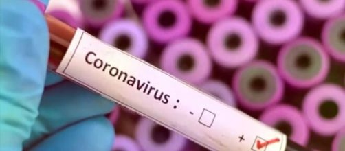 El gobierno de Honduras no ha podido satisfacer la necesidad de pruebas de coronavirus - hechoencalifornia1010.com