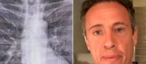 Âncora da CNN Chris Cuomo foi diagnosticado com a Covid-19. (Fotomontagem)