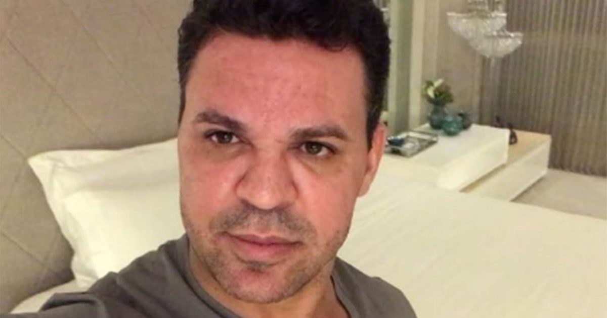 Eduardo Costa abre o jogo sobre cirurgias plásticas e confessa