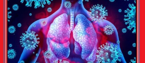 Le polmoniti da nuovo Coronavirus possono generare fibrosi polmonari che compromettono la funzionalità polmonare.